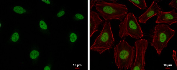Immunocytochemistry/ Immunofluorescence - Anti-Cullin 4B/CUL-4B antibody (AB227724), expandable thumbnail