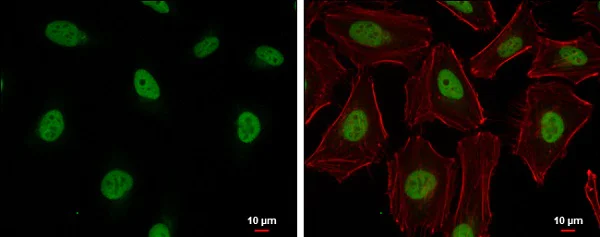 Immunocytochemistry/ Immunofluorescence - Anti-Cullin 4B/CUL-4B antibody (AB227724)
