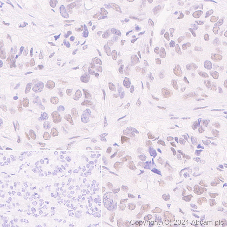 Immunohistochemistry (Formalin/PFA-fixed paraffin-embedded sections) - Anti-Cullin 4B/CUL-4B antibody [EPR26157-39] (AB317014)