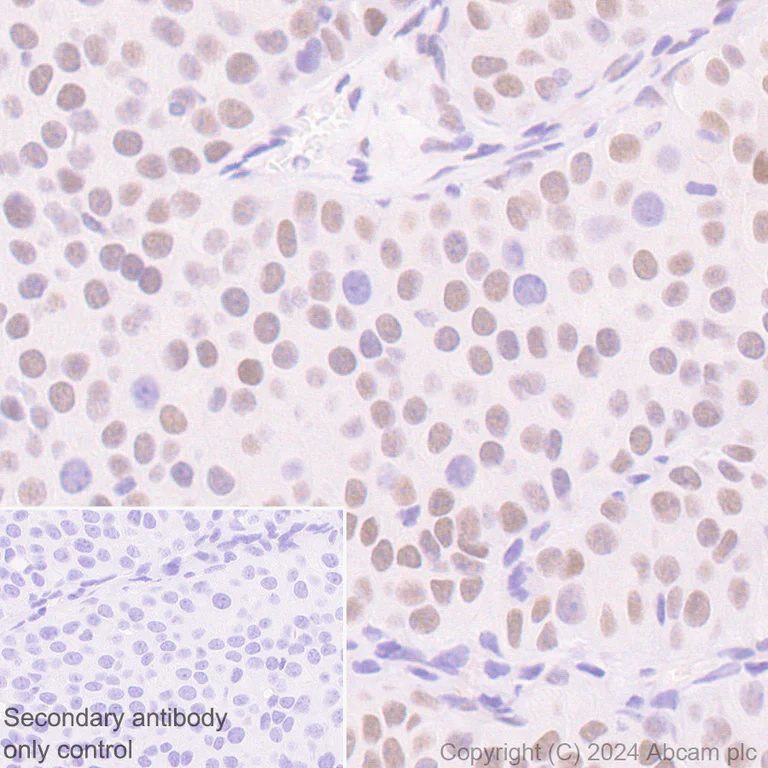 Immunohistochemistry (Formalin/PFA-fixed paraffin-embedded sections) - Anti-Cullin 4B/CUL-4B antibody [EPR26157-39] - BSA and Azide free (AB317015)
