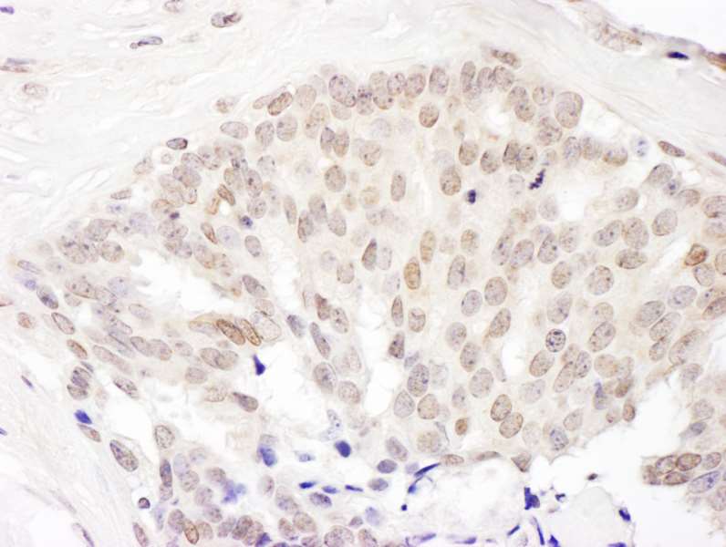 Immunohistochemistry (Formalin/PFA-fixed paraffin-embedded sections) - Anti-Cullin 5/CUL-5 antibody (AB264284), expandable thumbnail