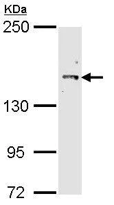 Western blot - Anti-Cullin 7/CUL-7 antibody (AB96861)
