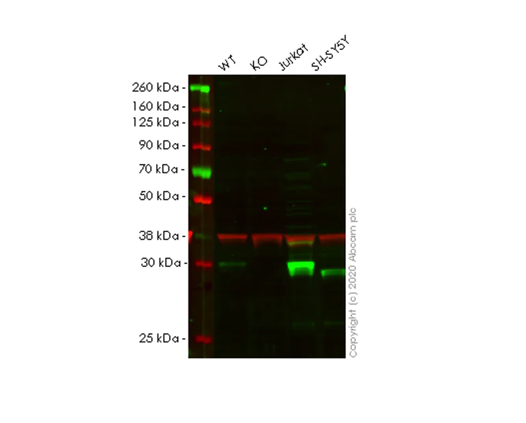 Western blot - Anti-CUTC antibody [EPR7929] - BSA and Azide free (AB248644)