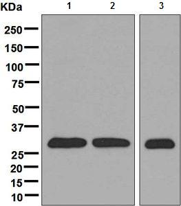 Western blot - Anti-CUTC antibody [EPR7929] - BSA and Azide free (AB248644), expandable thumbnail