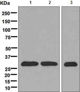 Western blot - Anti-CUTC antibody [EPR7929] - BSA and Azide free (AB248644)