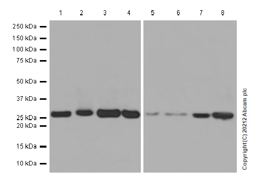 Western blot - Anti-CUTC antibody [EPR7929] - BSA and Azide free (AB248644)