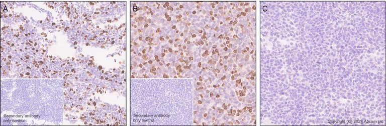Immunohistochemistry (Formalin/PFA-fixed paraffin-embedded sections) - Anti-CUX1+CUX2 antibody [EPR26509-154] (AB309139)