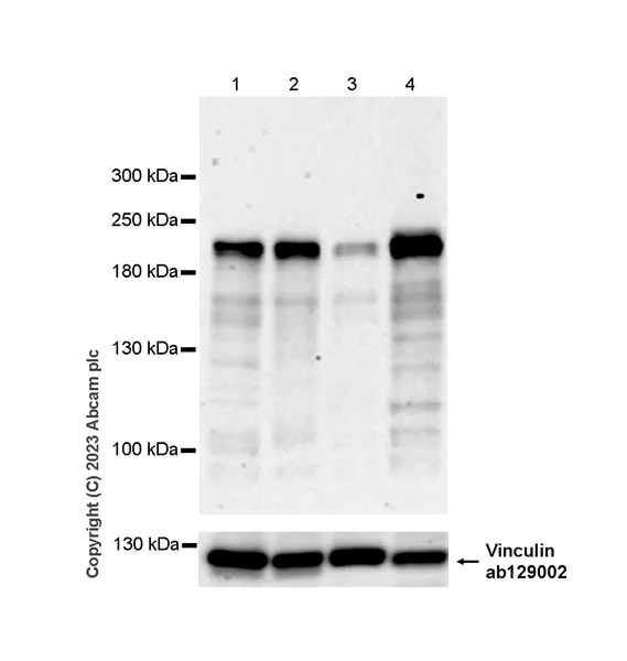 Western blot - Anti-CUX1+CUX2 antibody [EPR26509-154] (AB309139)