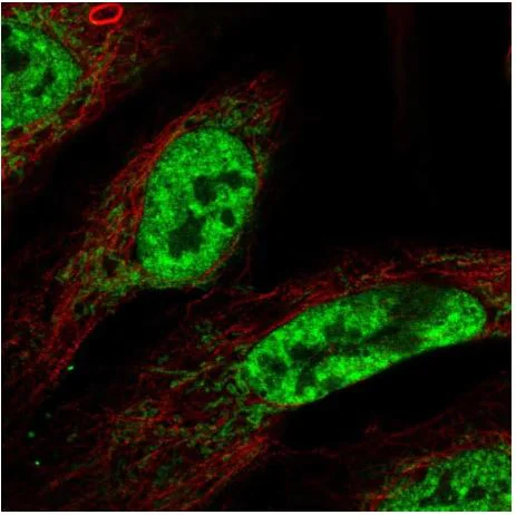 Immunocytochemistry/ Immunofluorescence - Anti-CWC15 antibody (AB188345)
