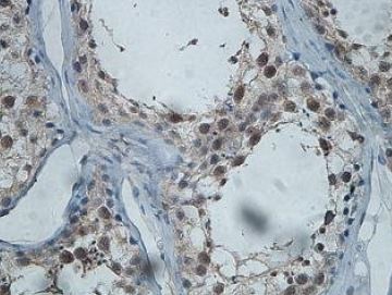 Immunohistochemistry (Formalin/PFA-fixed paraffin-embedded sections) - Anti-CWF19L2 antibody (AB201203)