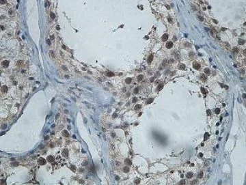 Immunohistochemistry (Formalin/PFA-fixed paraffin-embedded sections) - Anti-CWF19L2 antibody (AB201203)