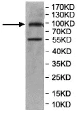 Western blot - Anti-CWF19L2 antibody (AB201203)