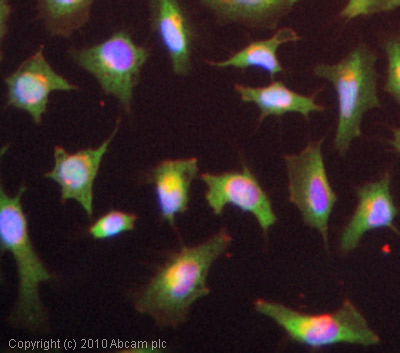 Immunocytochemistry/ Immunofluorescence - Anti-CX3CL1 antibody (AB25088), expandable thumbnail
