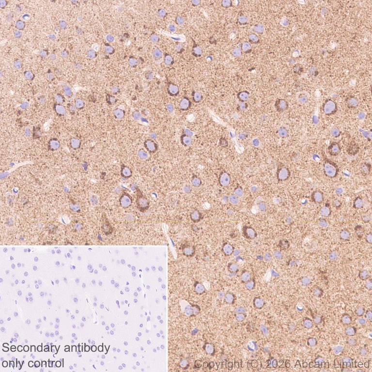 Immunohistochemistry (Formalin/PFA-fixed paraffin-embedded sections) - Anti-CX3CL1 antibody [EPR31278-537] (AB326930)