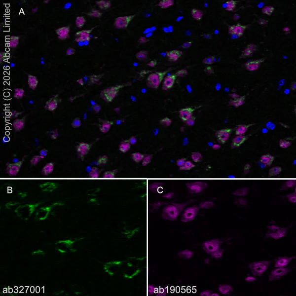 Immunohistochemistry (Frozen sections) - Anti-CX3CL1 antibody [EPR31278-578] (AB327001)