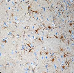 Immunohistochemistry (Formalin/PFA-fixed paraffin-embedded sections) - Anti-CX3CR1 antibody [8E10.D9] (AB184678)