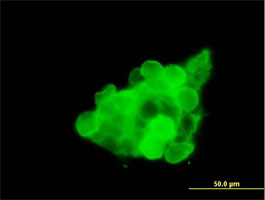 Immunocytochemistry/ Immunofluorescence - Anti-CX3CR1 antibody (AB167571)