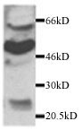 Western blot - Anti-CX3CR1 antibody (AB7201)