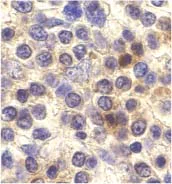 Immunohistochemistry (Formalin/PFA-fixed paraffin-embedded sections) - Anti-CX3CR1 antibody (AB8020)