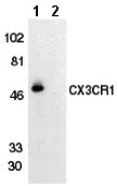 Western blot - Anti-CX3CR1 antibody (AB8020)