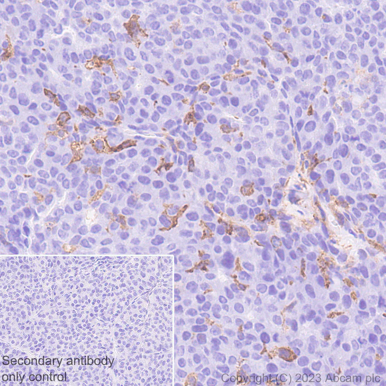 Immunohistochemistry (Formalin/PFA-fixed paraffin-embedded sections) - Anti-CX3CR1 antibody [EPR24267-2] (AB308613)