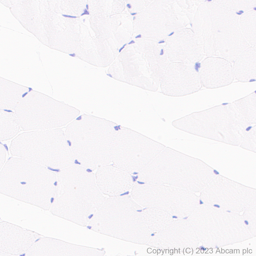 Immunohistochemistry (Formalin/PFA-fixed paraffin-embedded sections) - Anti-CX3CR1 antibody [EPR24267-2] (AB308613)
