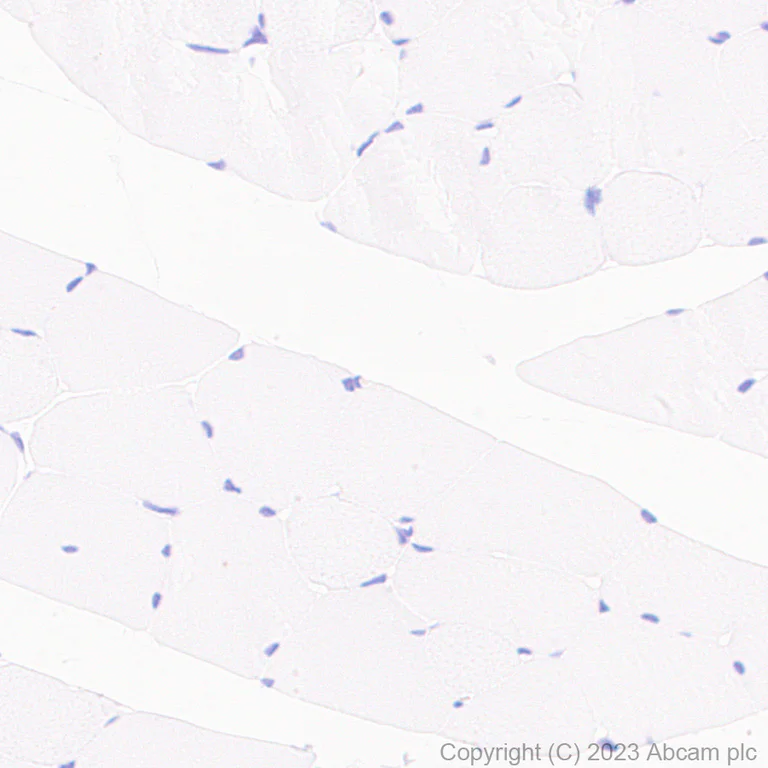 Immunohistochemistry (Formalin/PFA-fixed paraffin-embedded sections) - Anti-CX3CR1 antibody [EPR24267-2] (AB308613)