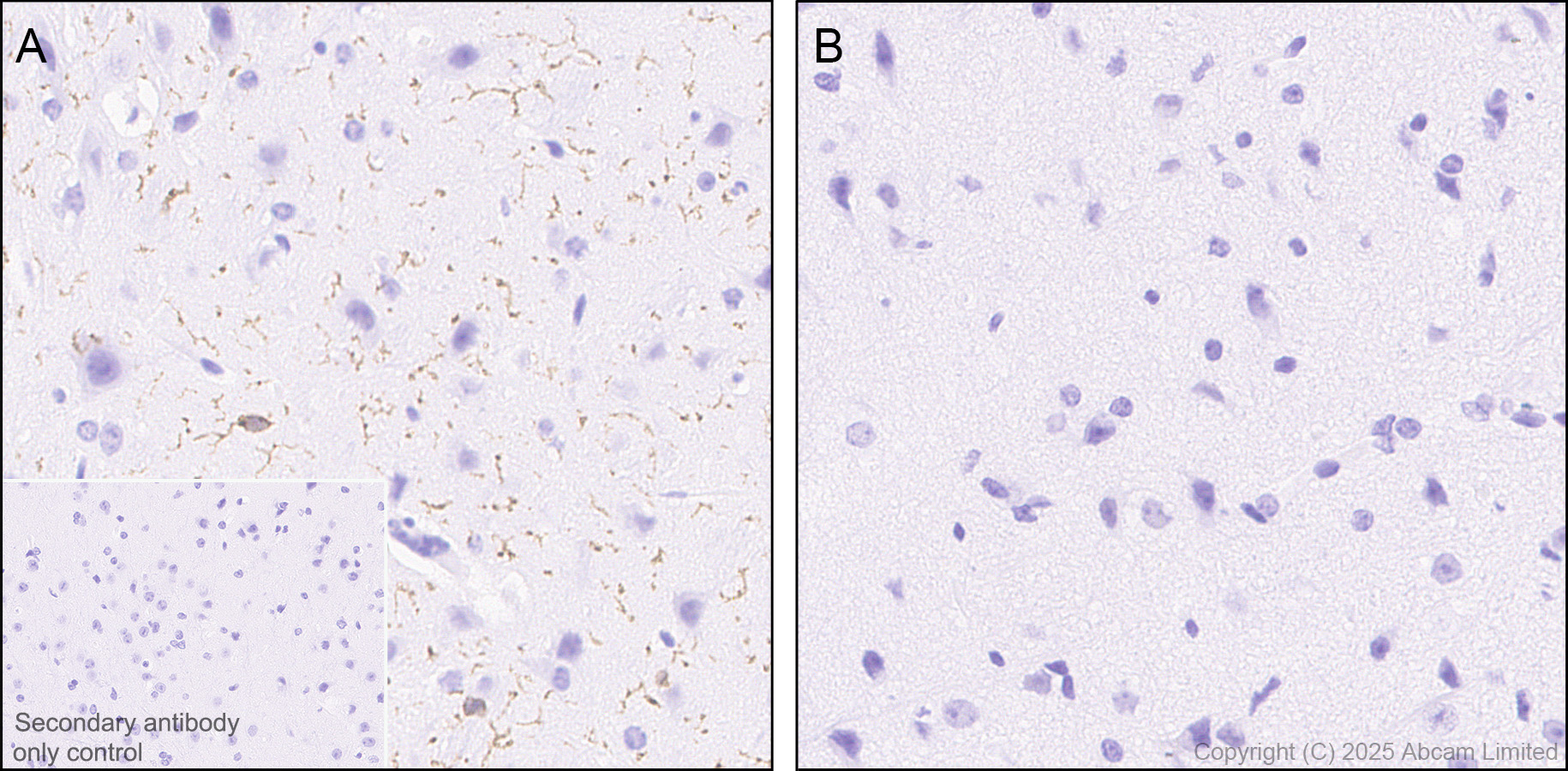 Immunohistochemistry (Formalin/PFA-fixed paraffin-embedded sections) - Anti-CX3CR1 antibody [EPR24267-2] (AB308613)