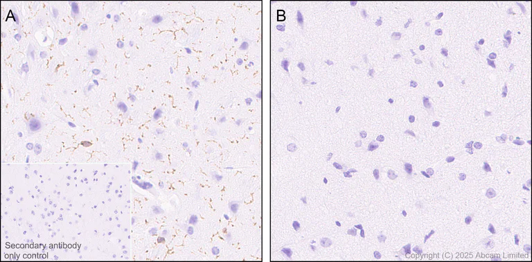 Immunohistochemistry (Formalin/PFA-fixed paraffin-embedded sections) - Anti-CX3CR1 antibody [EPR24267-2] (AB308613)