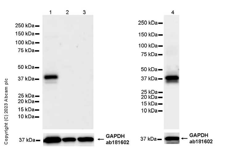 Western blot - Anti-Cx40/GJA5 antibody [EPR28370-62] - BSA and Azide free (AB313645)