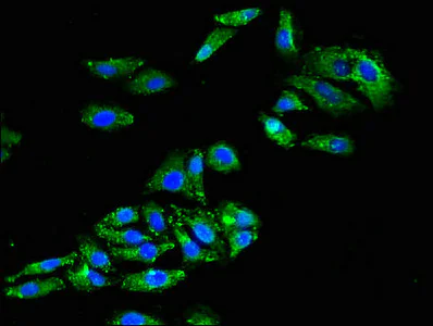Immunocytochemistry/ Immunofluorescence - Anti-Cx50 antibody (AB222885)