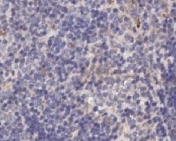 Immunohistochemistry (Formalin/PFA-fixed paraffin-embedded sections) - Anti-CXCL1/GRO alpha antibody (AB269939), expandable thumbnail