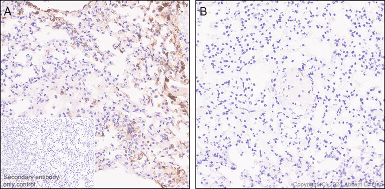 Immunohistochemistry (Formalin/PFA-fixed paraffin-embedded sections) - Anti-CXCL1/GRO alpha antibody [EPR28745-123] - BSA and Azide free (AB324777)