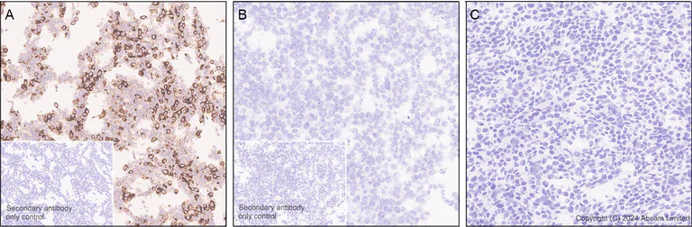 Immunohistochemistry (Formalin/PFA-fixed paraffin-embedded sections) - Anti-CXCL1/GRO alpha antibody [EPR28745-123] - BSA and Azide free (AB324777)