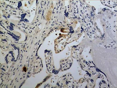 Immunohistochemistry (Formalin/PFA-fixed paraffin-embedded sections) - Anti-CXCL1/GRO alpha antibody [MM0208-9A18] (AB89318)