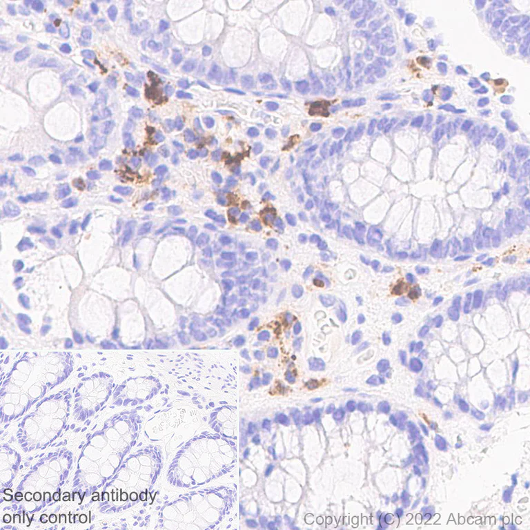 Immunohistochemistry (Formalin/PFA-fixed paraffin-embedded sections) - Anti-CXCL10/IP-10 antibody [EPR24674-84] - BSA and Azide free (AB306588)