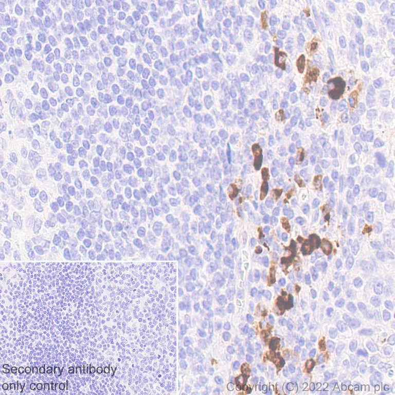 Immunohistochemistry (Formalin/PFA-fixed paraffin-embedded sections) - Anti-CXCL10/IP-10 antibody [EPR24674-84] - BSA and Azide free (AB306588)