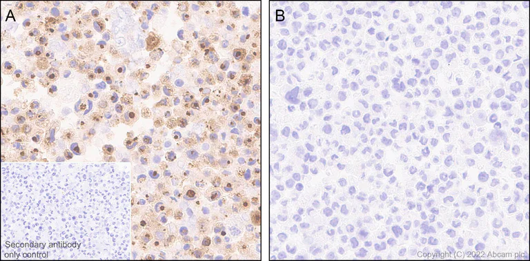 Immunohistochemistry (Formalin/PFA-fixed paraffin-embedded sections) - Anti-CXCL10/IP-10 antibody [EPR24674-84] - BSA and Azide free (AB306588)