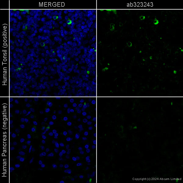 Immunohistochemistry (Formalin/PFA-fixed paraffin-embedded sections) - Anti-CXCL10/IP-10 antibody [EPR24674-84] – Mouse IgG1 (Chimeric) (AB323243)