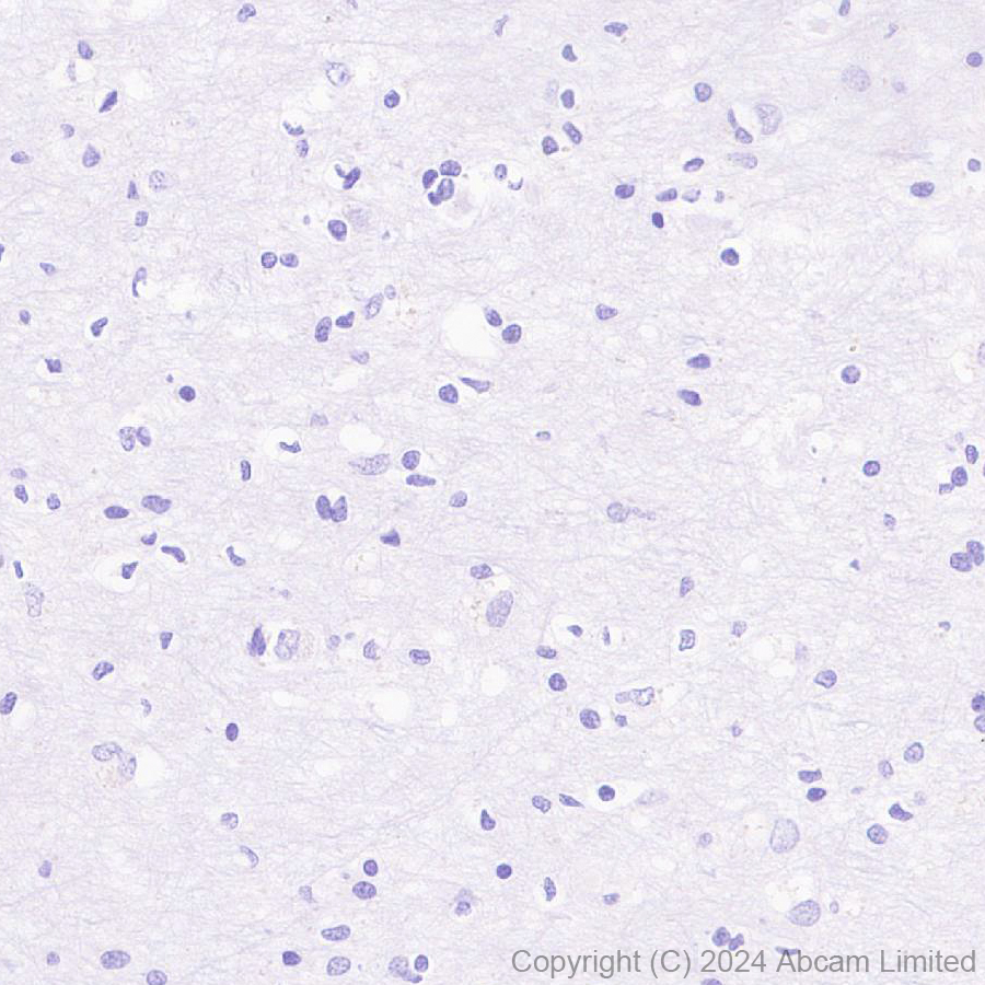 Immunohistochemistry (Formalin/PFA-fixed paraffin-embedded sections) - Anti-CXCL10/IP-10 antibody [RM2054] (AB318282)