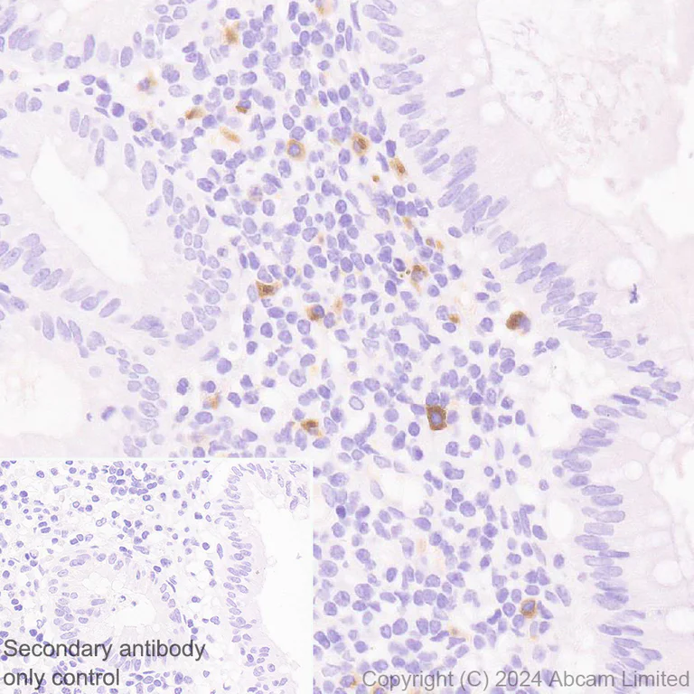 Immunohistochemistry (Formalin/PFA-fixed paraffin-embedded sections) - Anti-CXCL10/IP-10 antibody [RM2054] - BSA and Azide free (AB318283)