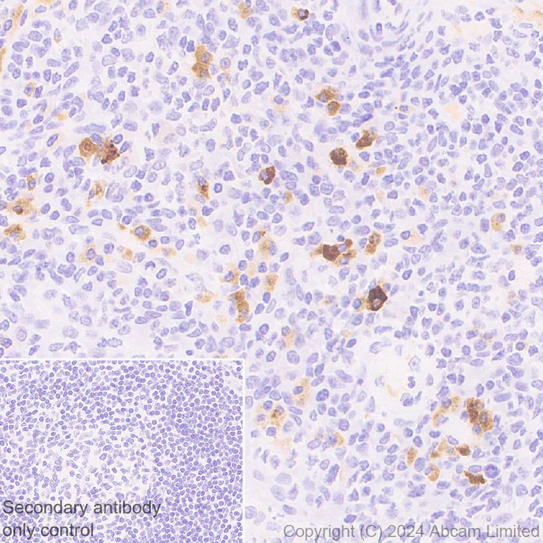Immunohistochemistry (Formalin/PFA-fixed paraffin-embedded sections) - Anti-CXCL10/IP-10 antibody [RM2054] - BSA and Azide free (AB318283)