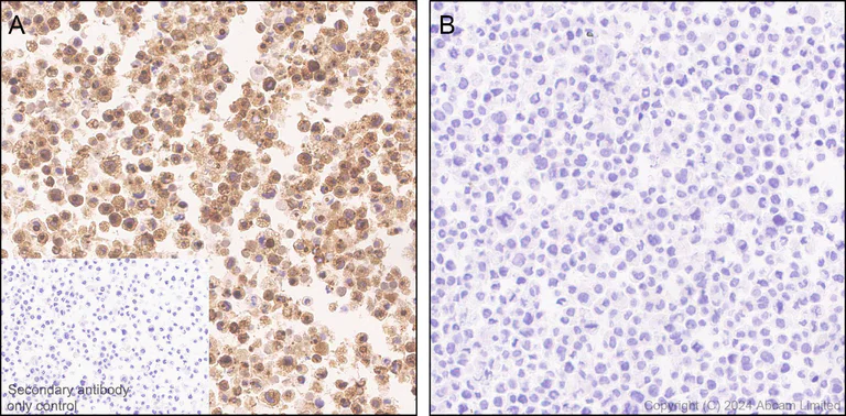 Immunohistochemistry (Formalin/PFA-fixed paraffin-embedded sections) - Anti-CXCL10/IP-10 antibody [RM2054] - BSA and Azide free (AB318283)