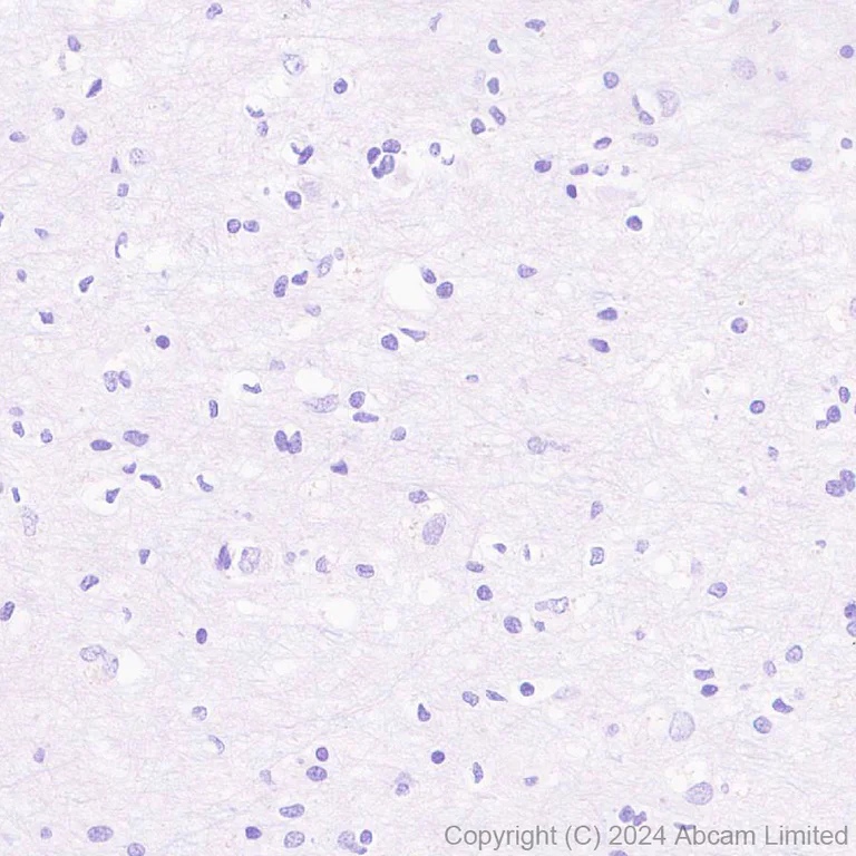 Immunohistochemistry (Formalin/PFA-fixed paraffin-embedded sections) - Anti-CXCL10/IP-10 antibody [RM2054] - BSA and Azide free (AB318283)