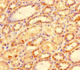 Immunohistochemistry (Formalin/PFA-fixed paraffin-embedded sections) - Anti-CXCL11 antibody (AB235977)