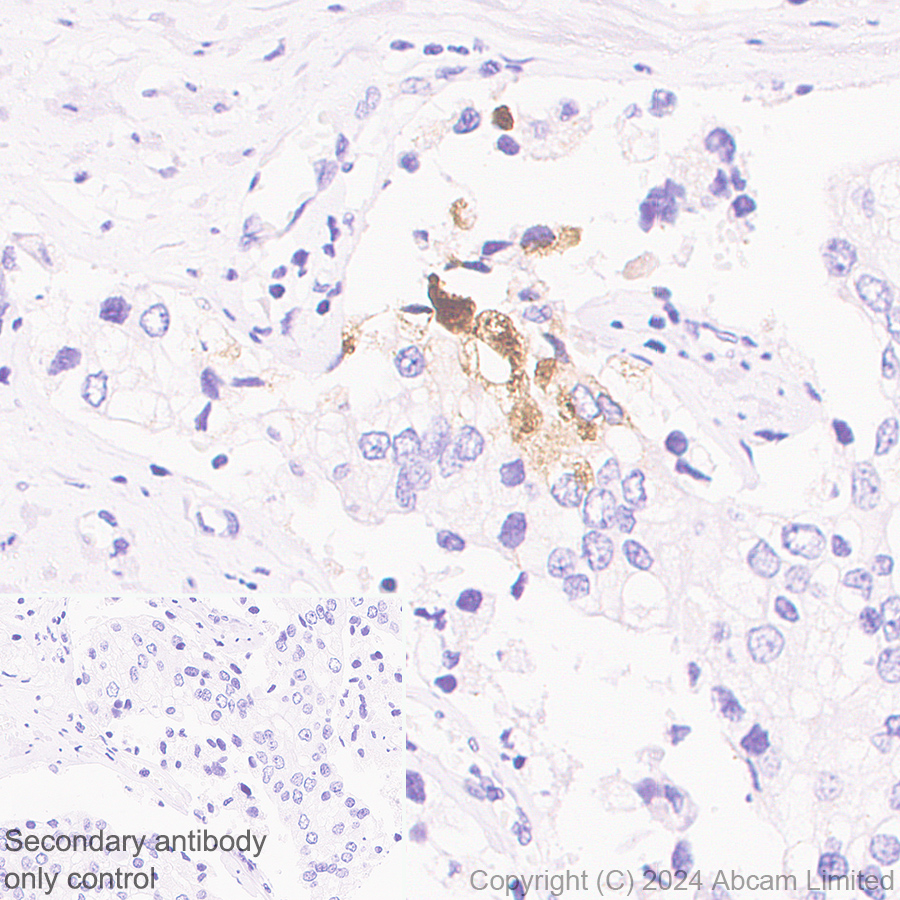 Immunohistochemistry (Formalin/PFA-fixed paraffin-embedded sections) - Anti-CXCL11 antibody [EPR27375-62] (AB322902), expandable thumbnail