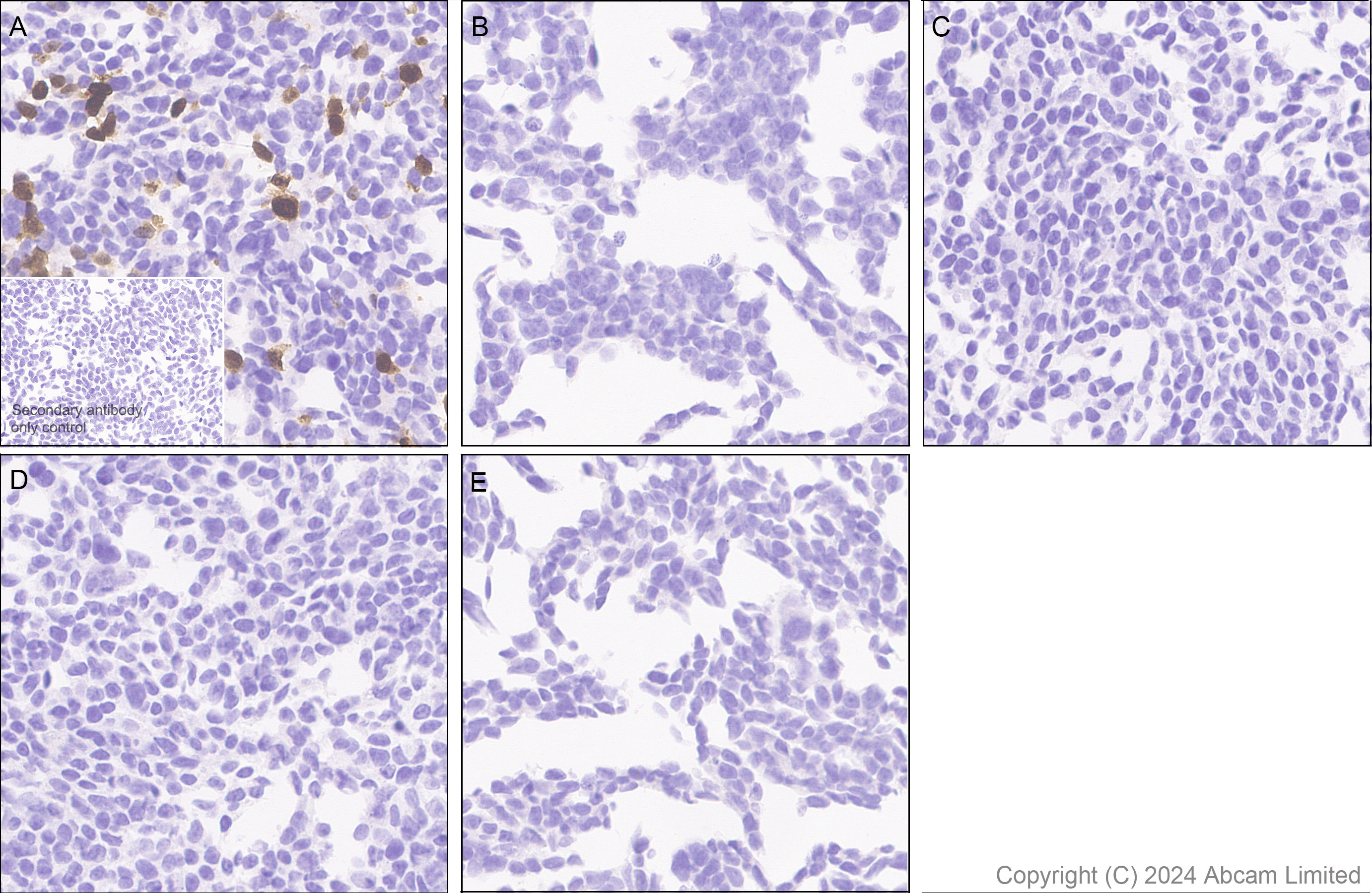 Immunohistochemistry (Formalin/PFA-fixed paraffin-embedded sections) - Anti-CXCL11 antibody [EPR27375-62] (AB322902), expandable thumbnail