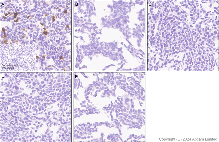 Immunohistochemistry (Formalin/PFA-fixed paraffin-embedded sections) - Anti-CXCL11 antibody [EPR27375-62] (AB322902)