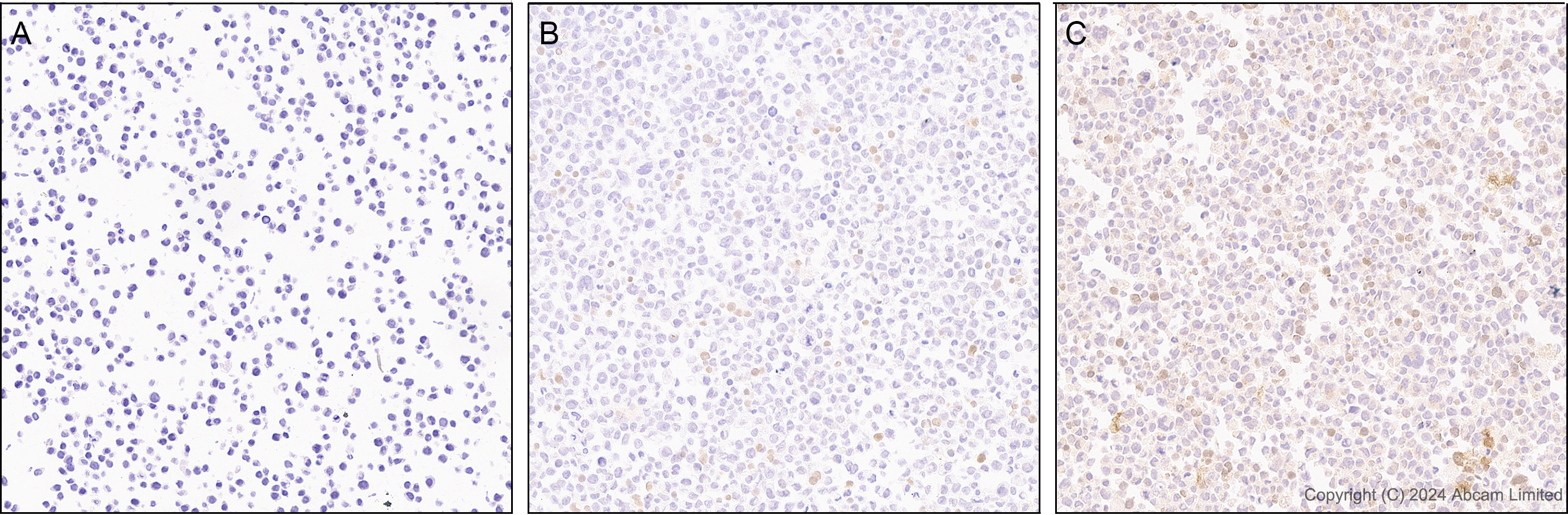 Immunohistochemistry (Formalin/PFA-fixed paraffin-embedded sections) - Anti-CXCL11 antibody [EPR27375-62] (AB322902), expandable thumbnail