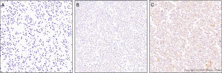 Immunohistochemistry (Formalin/PFA-fixed paraffin-embedded sections) - Anti-CXCL11 antibody [EPR27375-62] (AB322902)